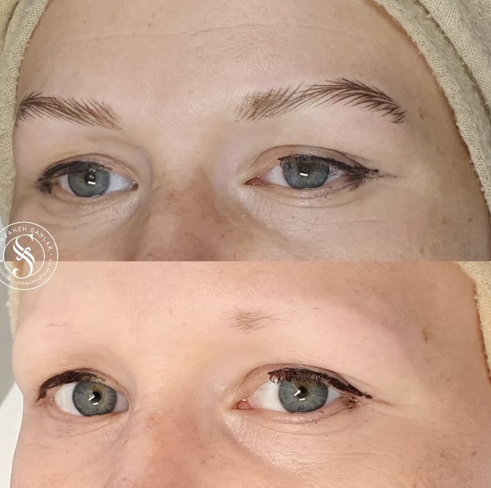 Hyperrealistiske bryn resultat hos Prettier.dk – billede 8