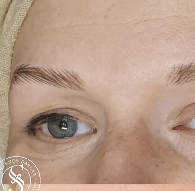 Hyperrealistiske bryn resultat hos Prettier.dk – billede 7