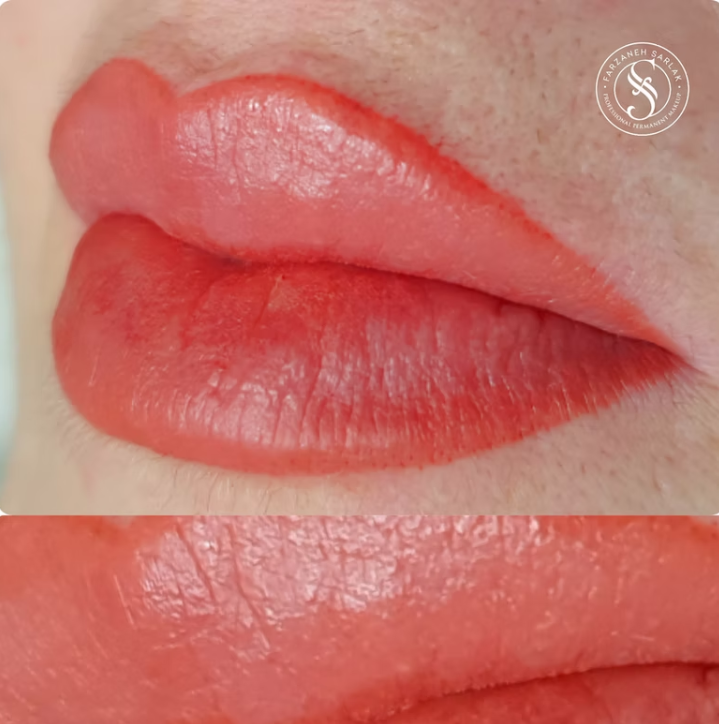 Permanent makeup læber resultat hos Prettier.dk – billede 10