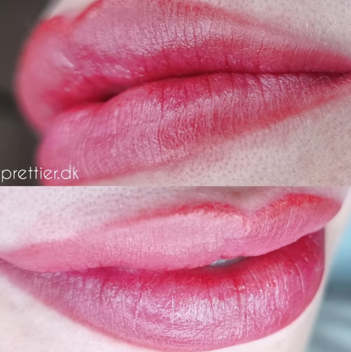 Permanent makeup læber resultat hos Prettier.dk – billede 5