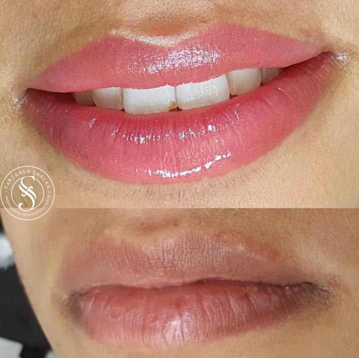 Permanent makeup læber resultat hos Prettier.dk – billede 8
