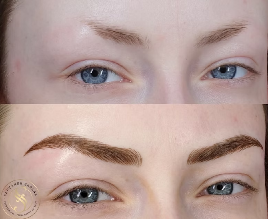 Hybrid bryn resultat hos Prettier.dk