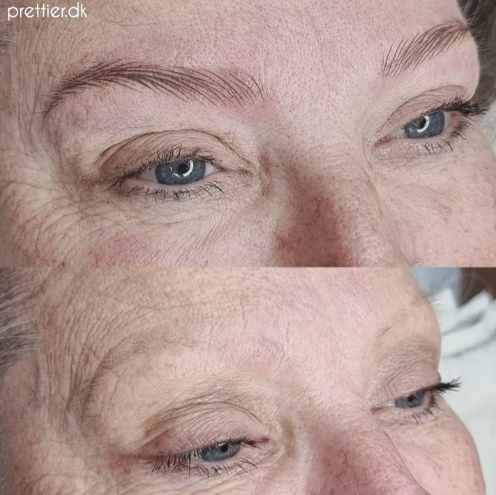 Hyperrealistiske bryn resultat hos Prettier.dk – billede 20