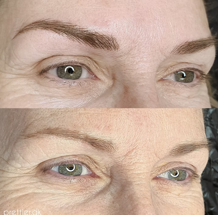 Hyperrealistiske bryn resultat hos Prettier.dk – billede 15
