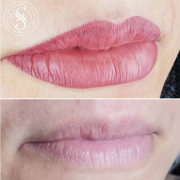 Permanent makeup læber resultat hos Prettier.dk – billede 15