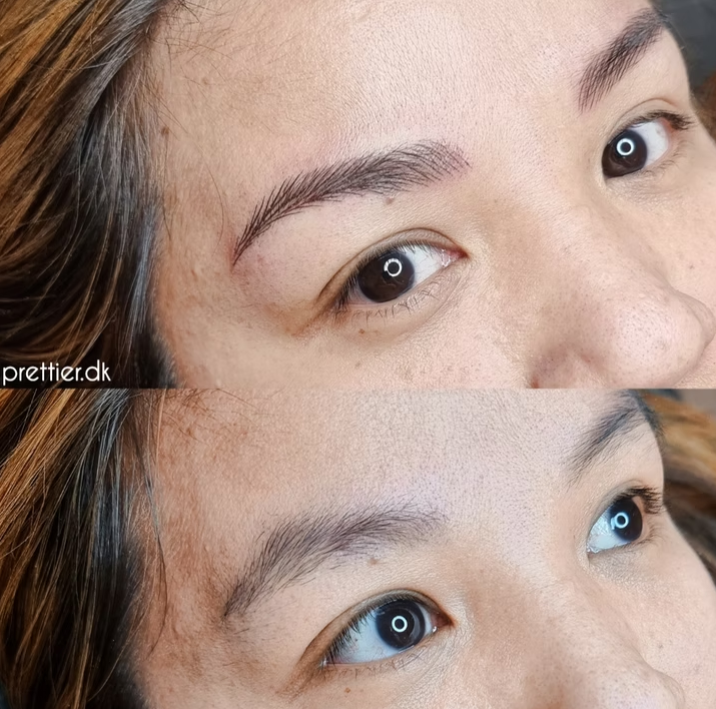 Hyperrealistiske bryn resultat hos Prettier.dk – billede 21