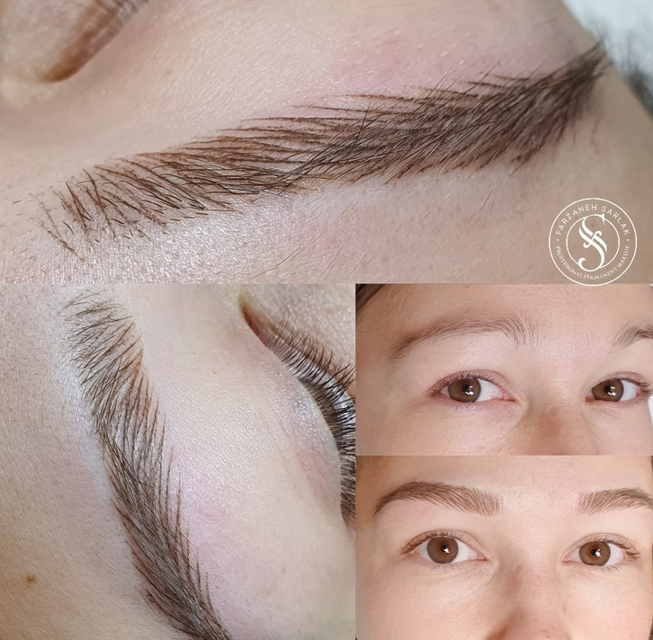 Hyperrealistiske bryn resultat hos Prettier.dk – billede 6