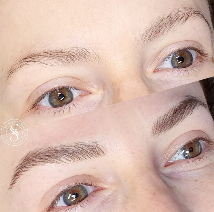 Hyperrealistiske bryn resultat hos Prettier.dk – billede 22