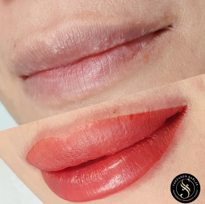 Permanent makeup læber resultat hos Prettier.dk – billede 7