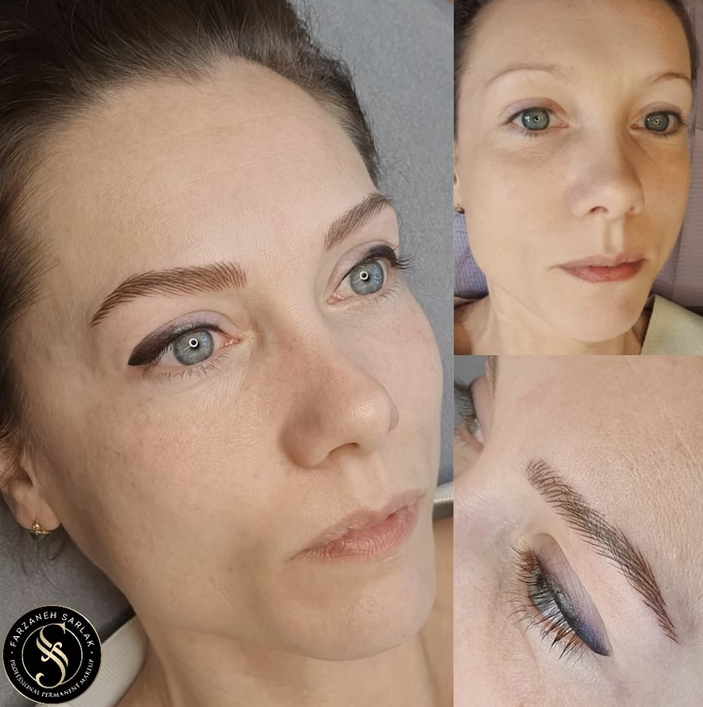 Hyperrealistiske bryn resultat hos Prettier.dk – billede 10