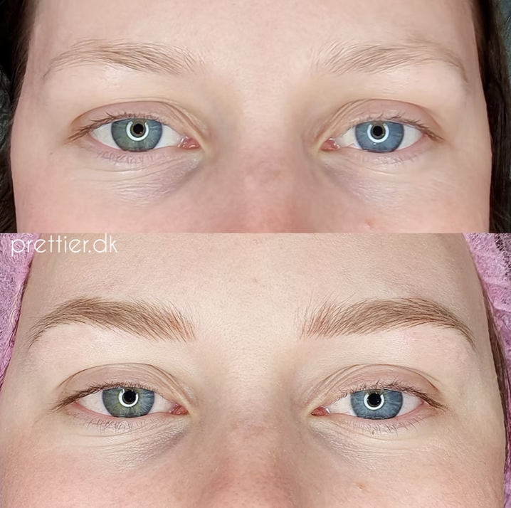 Hyperrealistiske bryn resultat hos Prettier.dk – billede 19